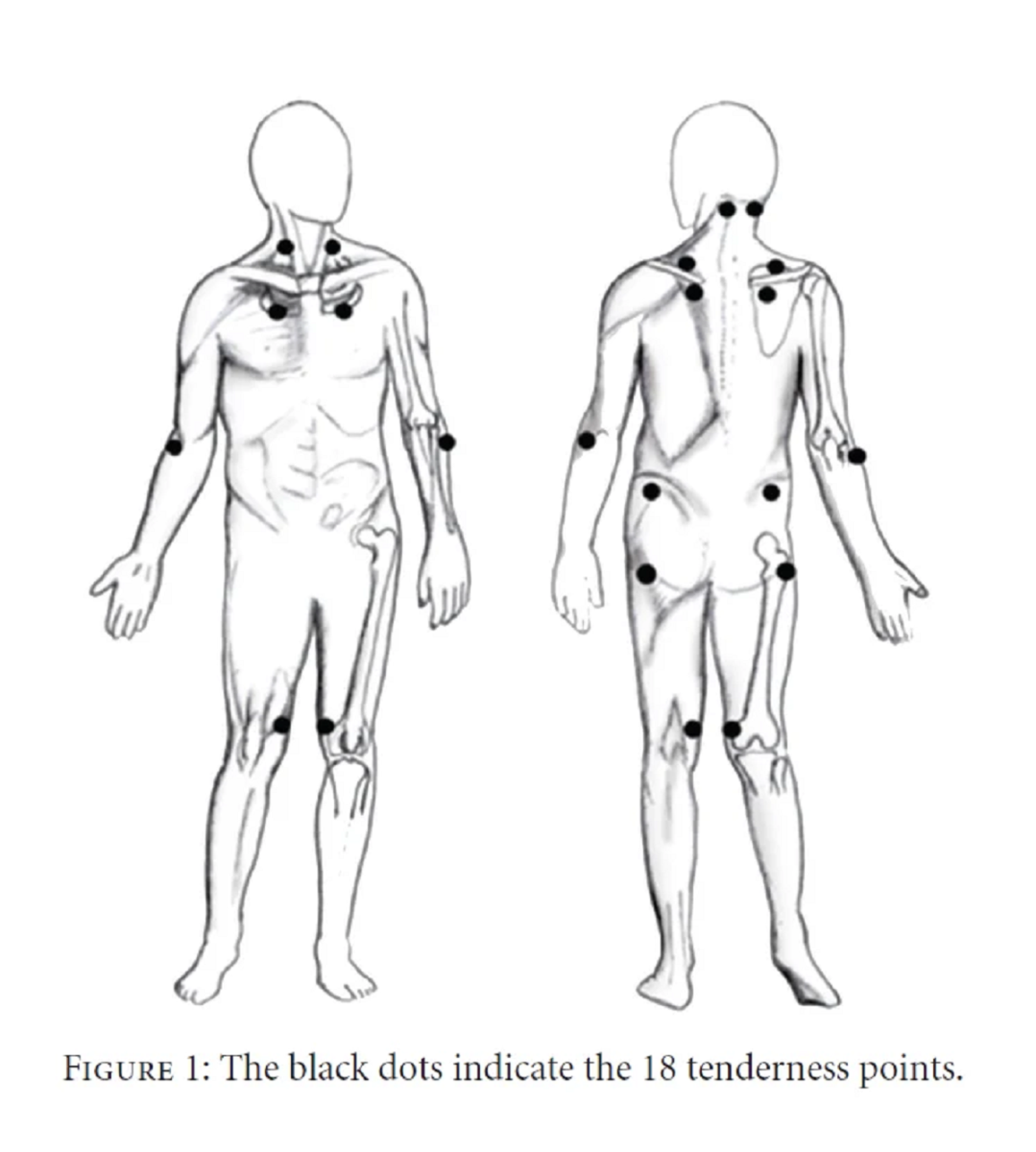 بیماری فیبرومیالژیا چیست و علائم، دلایل و راه‌های درمان آن چگونه است