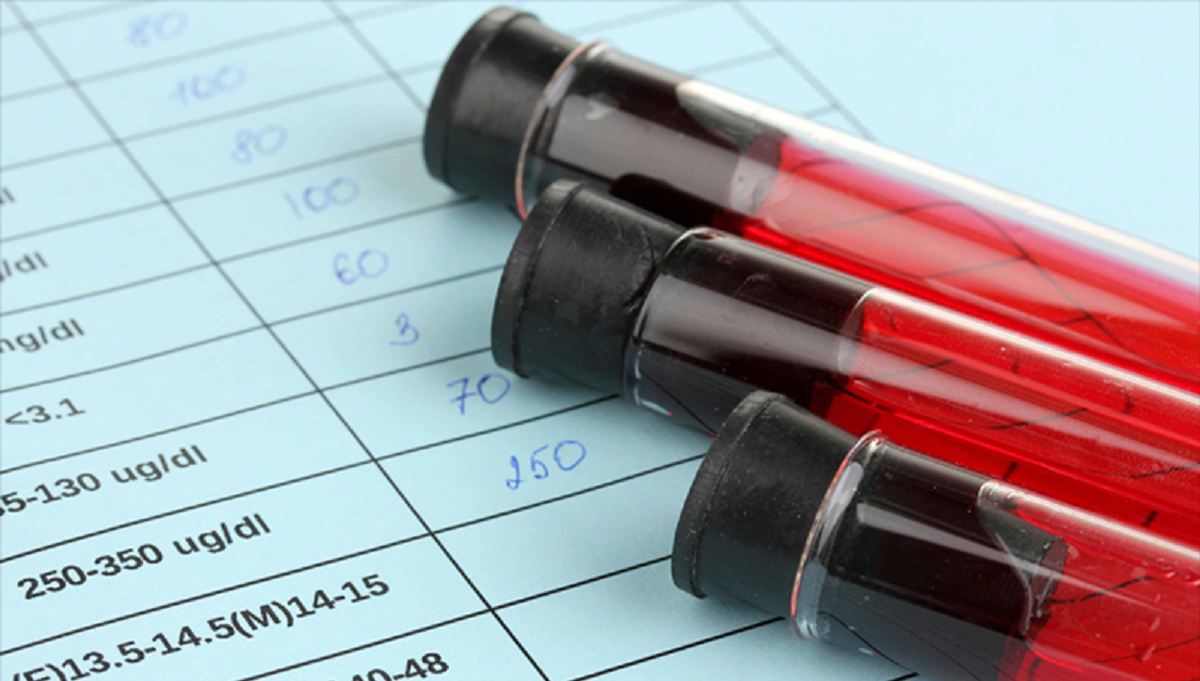 علائم و علل سندرم تخمدان پلی‌کیستیک (PCOS) و تشخیص و درمان آن