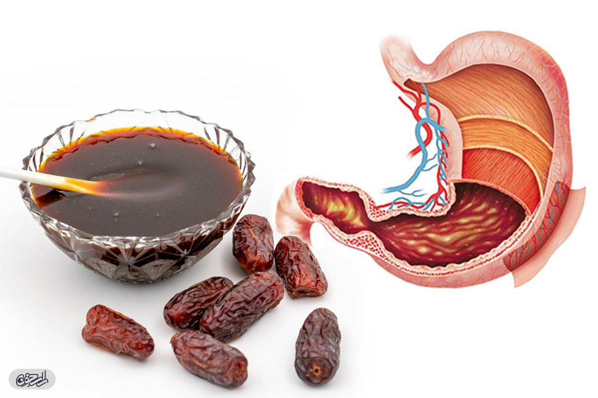 آشنایی با فواید شیره خرما