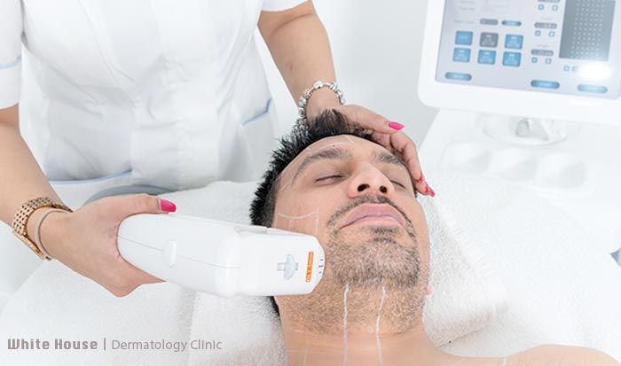 لیفت صورت در آقایان