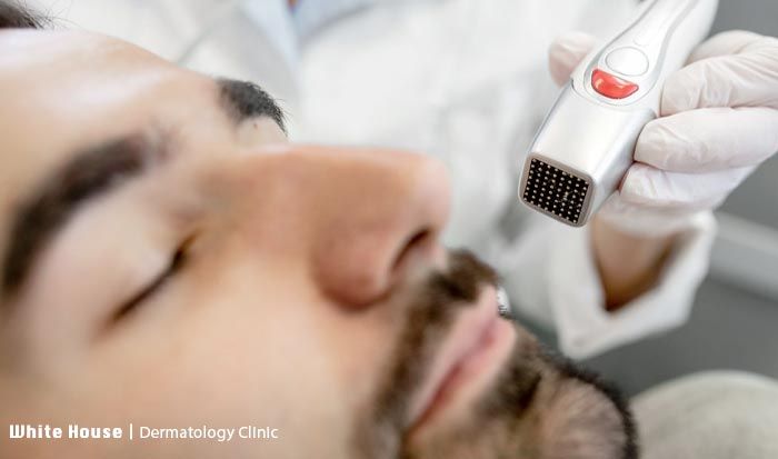 لیفت صورت در آقایان