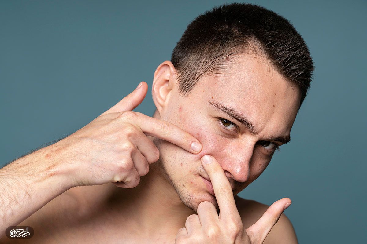 همه چیز درباره جوش