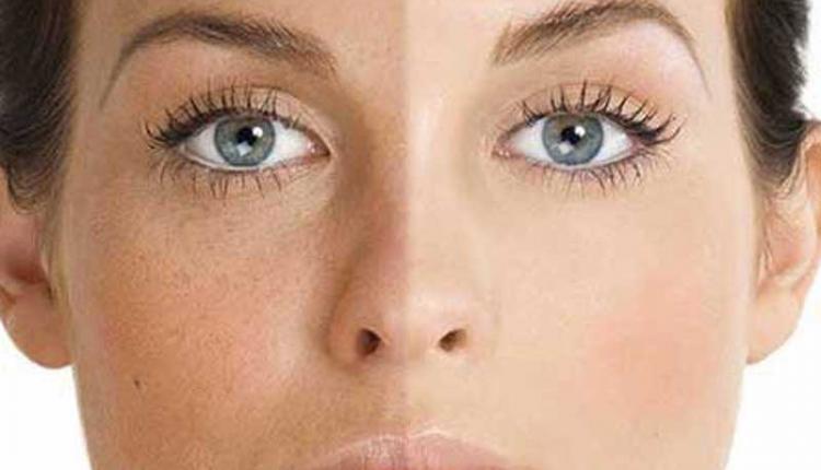 گل پائونیا یا گل صد تومانی (Paeonia ) گل پائونیا یا گل صد تومانی (Paeonia )