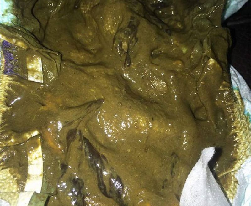 راهنمای تصویری انواع مدفوع نوزاد