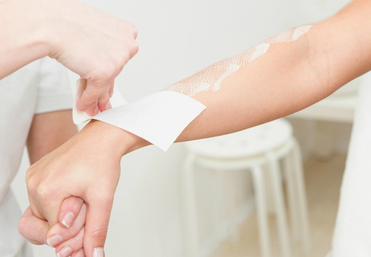 لیزر در بارداری لیزر در بارداری