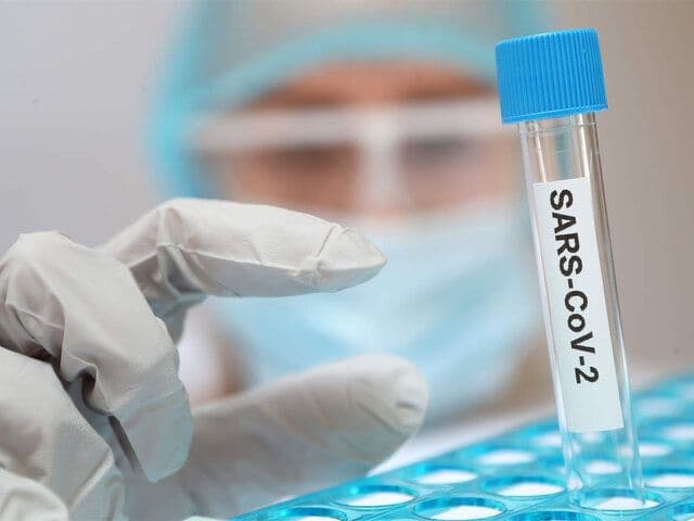 آخرین اخبار مربوط به Covid19 در ایران و جهان