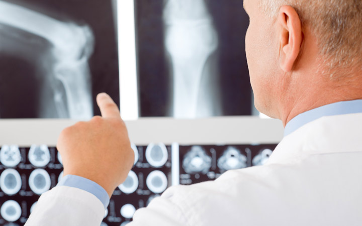 یائسگی زودرس یائسگی زودرس