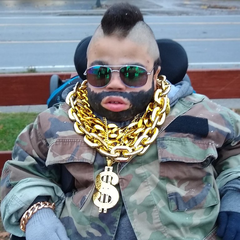 آشنایی با بیماری ام پی اس (MPS)