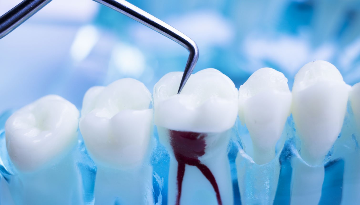 آیا عفونت دندان باعث مرگ میشود؟ آیا عفونت دندان باعث مرگ میشود؟