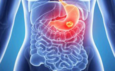 انواع اختلالات متابولیکی