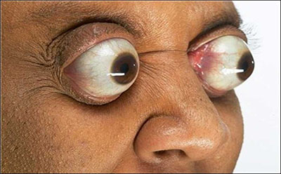  چرا چپ چپ نگاه می‌کنی؟