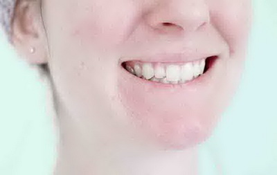  آموزش ماساژ صورت