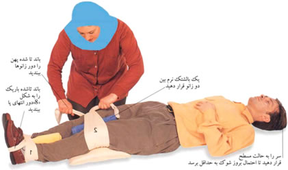 كمكهاي اوليه شکستگي لگن كمكهاي اوليه شکستگي لگن