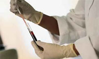 ديابتي&zwnj;ها و آزمايش A1C