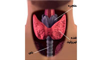 تيروييد سمي