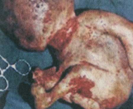 مهمانان ناخوانده زمین