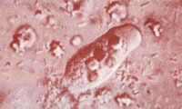  آميبياز