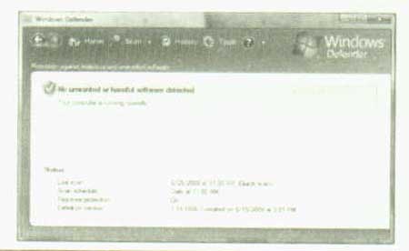 کالبد شکافی ویستا