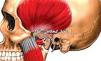 سندرم (سندرم مفصل گيجگاهى فكى)