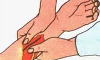 اسكار (جاى زخم) 