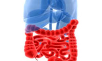سندرم روده تحريك پذير 