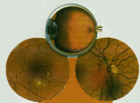 چشم هايش