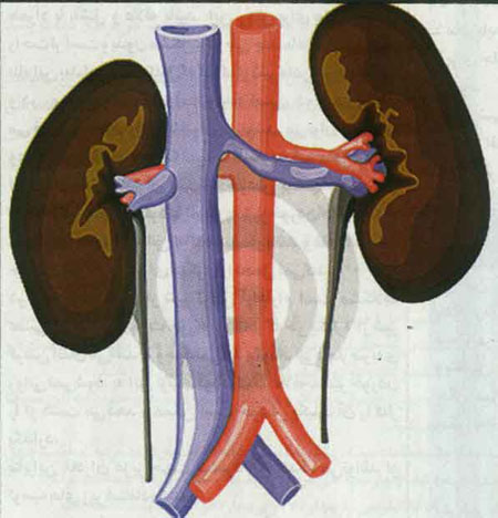 عوارض پيوند کليه