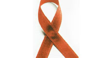 تغذیه و ارتقای سلامت در مبتلایان به ایدز