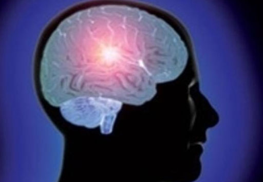 همه چیز درباره سردرد خانم‌ها