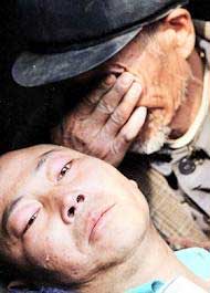 بیماری‌ای به نام ایدز