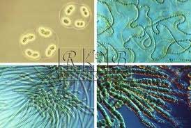 پدیده‌ی نورساخت (فوتوسنتز)