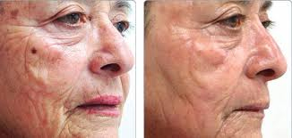 تئوری طول عمر