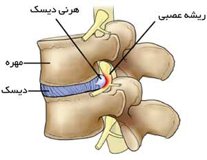 کهنه‌ترین درد بشر