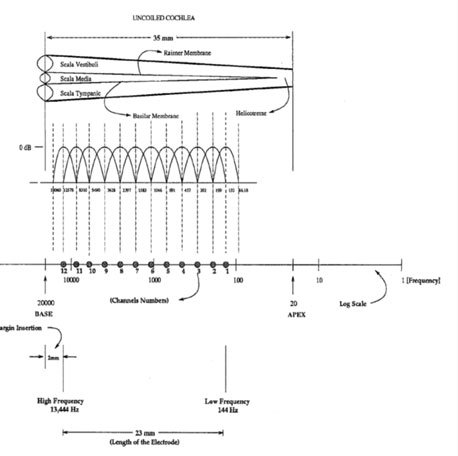 پروتزهای شنوایی؛ مطالعه، طراحی و چالش‌های طراحی