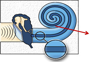 پروتزهای شنوایی؛ مطالعه، طراحی و چالش‌های طراحی