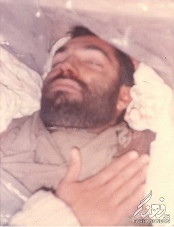 سرداری که با یک پا می جنگید 