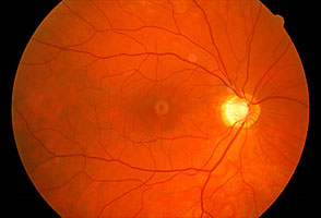 در مورد بیماری‌های چشم چه می‌دانید؟