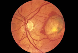 در مورد بیماری‌های چشم چه می‌دانید؟