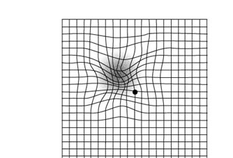 در مورد بیماری‌های چشم چه می‌دانید؟