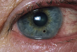 در مورد بیماری‌های چشم چه می‌دانید؟