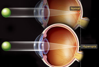 در مورد بیماری‌های چشم چه می‌دانید؟