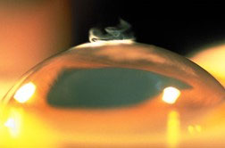 در مورد بیماری‌های چشم چه می‌دانید؟