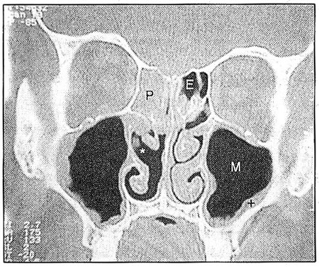 نگرش گشتالتی و ادراك