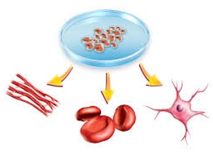 درمان به روش سلول‌های بنیادی