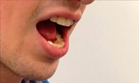 علل بوی بد دهان