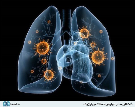 جنگی که روزانه جان هزاران نفر را می‌گیرد