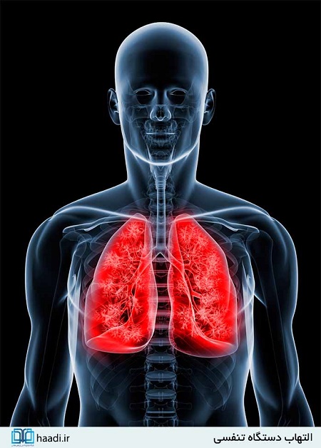 جنگی که روزانه جان هزاران نفر را می‌گیرد