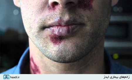 جنگی که روزانه جان هزاران نفر را می‌گیرد