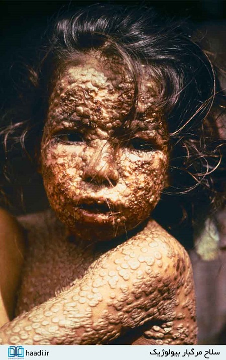 جنگی که روزانه جان هزاران نفر را می‌گیرد