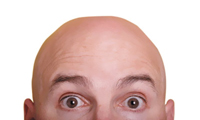 کچل 